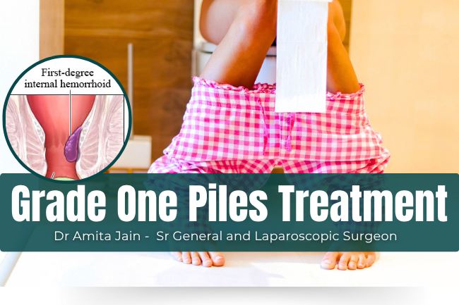 Grade 1 Piles Internal Hemorrhoids treatment Dr Amita Jain